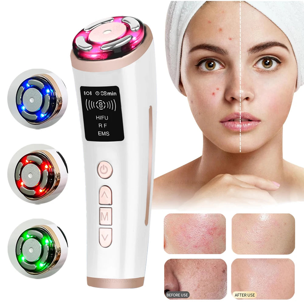 HIFU Face Lifting Machine - EMS Microcurrent Skin Rejuvenation Massager - JStorehub 