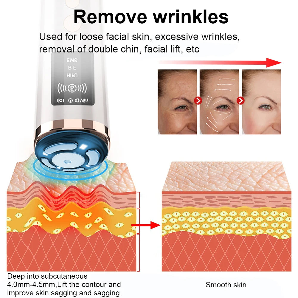 HIFU Face Lifting Machine - EMS Microcurrent Skin Rejuvenation Massager - JStorehub 
