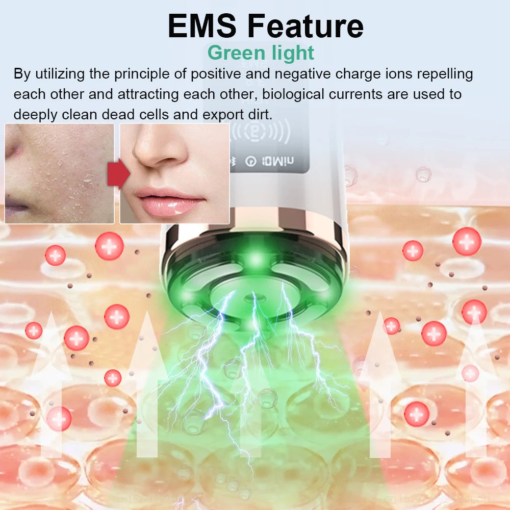 HIFU Face Lifting Machine - EMS Microcurrent Skin Rejuvenation Massager - JStorehub 