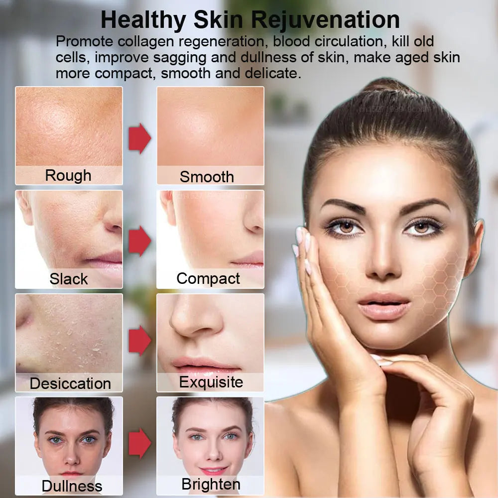 HIFU Face Lifting Machine - EMS Microcurrent Skin Rejuvenation Massager - JStorehub 